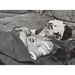 Photo of wounded GI's on ship in Southern France
